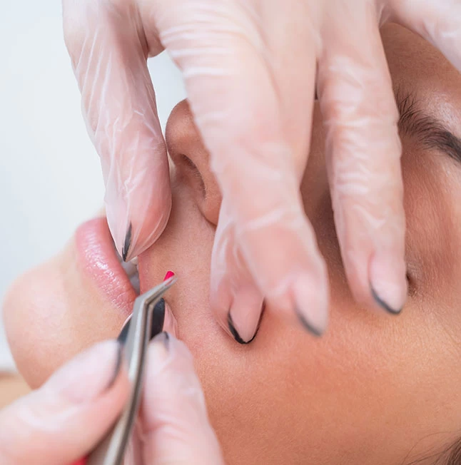 Hair Removal Methods — Electrolysis Beauty Lounge
