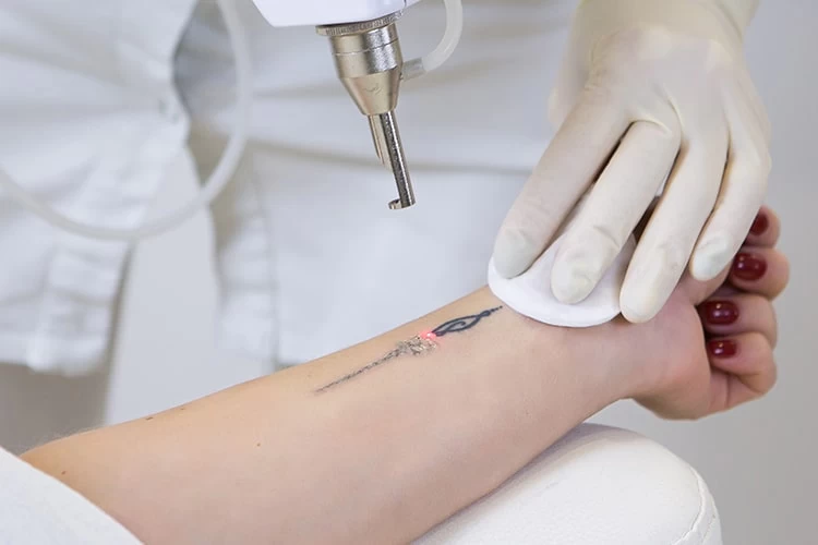 Eraser Clinic Brings MultiWavelength Astanza Trinity Laser Tattoo Removal  To Houston TX