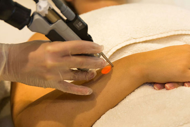 Hair Removal