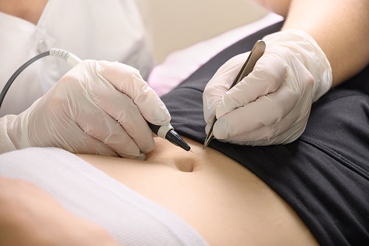 Electrolysis treatments