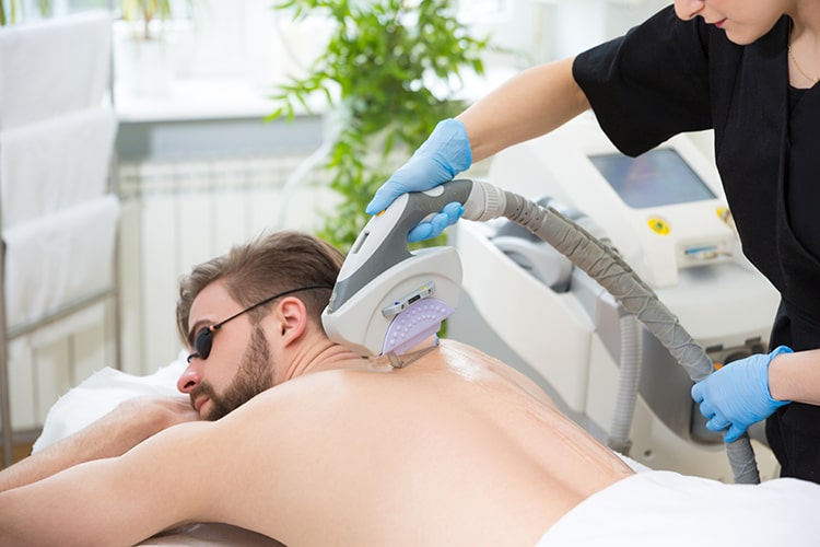 Laser Hair Removal